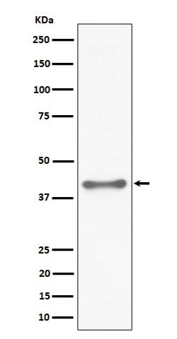 Anti-TTF1 Rabbit Monoclonal Antibody Boster Bio