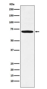 Anti-LIMK1 Rabbit Monoclonal Antibody Boster Bio
