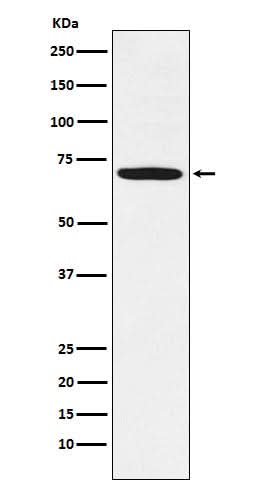 Anti-LIMK1 Rabbit Monoclonal Antibody Boster Bio