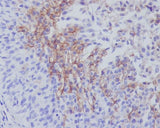 Anti-Thrombomodulin THBD Rabbit Monoclonal Antibody Boster Bio