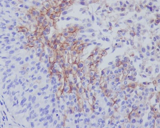 Anti-Thrombomodulin THBD Rabbit Monoclonal Antibody Boster Bio