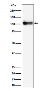 Anti-Thrombomodulin / CD141 Rabbit Monoclonal Antibody Boster Bio