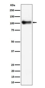 Anti-Thrombomodulin / CD141 Rabbit Monoclonal Antibody Boster Bio