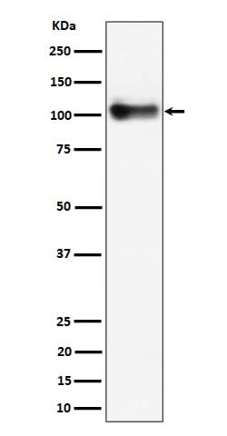 Anti-Thrombomodulin / CD141 Rabbit Monoclonal Antibody Boster Bio