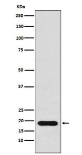 Anti-NM23 Rabbit Monoclonal Antibody Boster Bio