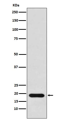 Anti-NM23 Rabbit Monoclonal Antibody Boster Bio
