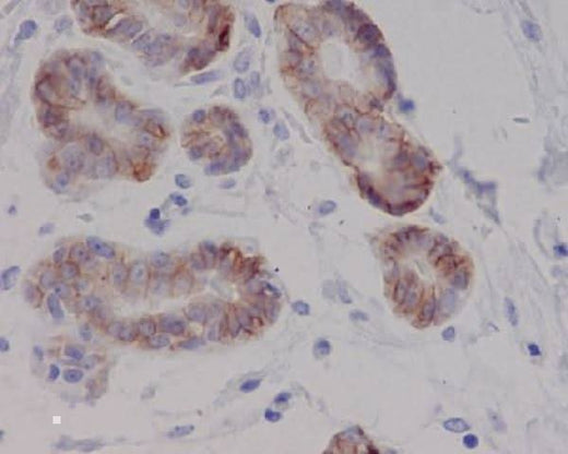 Anti-c-Kit Rabbit Monoclonal Antibody Boster Bio