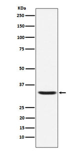 Anti-Hepcidin HAMP Rabbit Monoclonal Antibody Boster Bio
