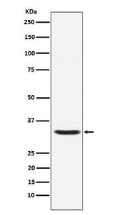 Anti-Hepcidin HAMP Rabbit Monoclonal Antibody Boster Bio