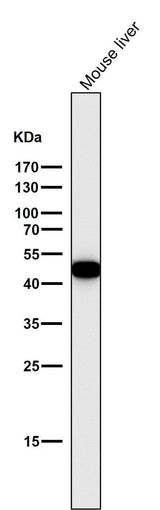 Anti-Cytokeratin 18 KRT18 Rabbit Monoclonal Antibody Boster Bio