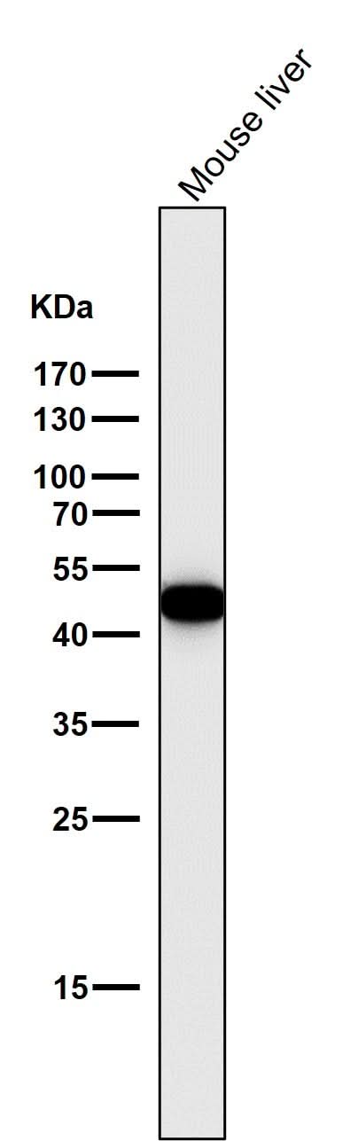 Anti-Cytokeratin 18 KRT18 Rabbit Monoclonal Antibody Boster Bio