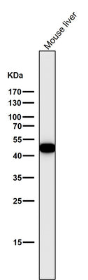 Anti-Cytokeratin 18 KRT18 Rabbit Monoclonal Antibody Boster Bio