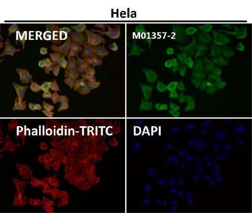Anti-Cytokeratin 18 Krt18 Rabbit Monoclonal Antibody Boster Bio