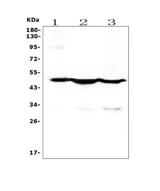 Anti-Cytokeratin 18 KRT18 Antibody Picoband®(monoclonal, 7I6 Boster Bio