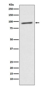 Anti-STAT2 Rabbit Monoclonal Antibody Boster Bio