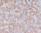 Anti-Serum Amyloid A SAA1 Rabbit Monoclonal Antibody Boster Bio