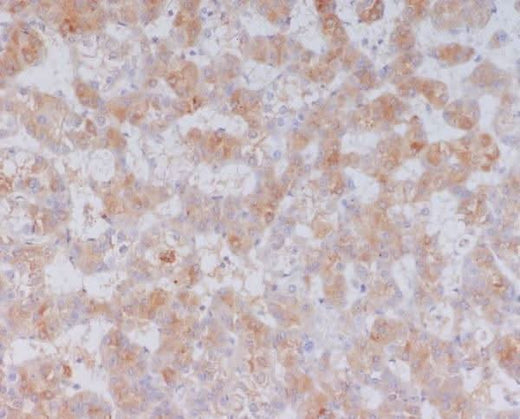Anti-Serum Amyloid A SAA1 Rabbit Monoclonal Antibody Boster Bio