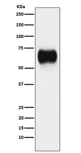 Anti-MICA Rabbit Monoclonal Antibody Boster Bio
