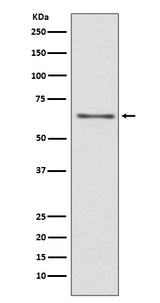 Anti-CDC45/Cdc45L Rabbit Monoclonal Antibody Boster Bio