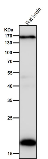 Anti-Pleiotrophin Rabbit Monoclonal Antibody Boster Bio