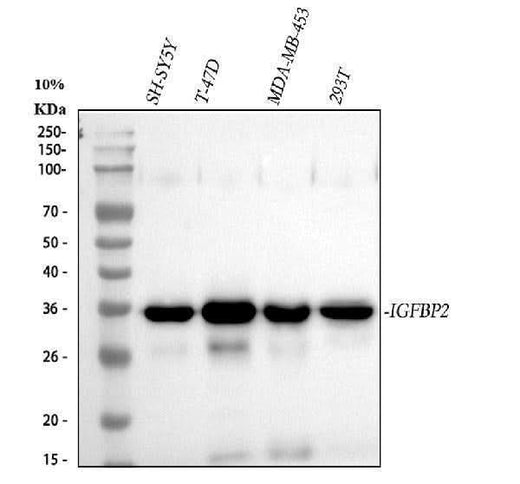 Anti-IGFBP2 Rabbit Monoclonal Antibody Boster Bio