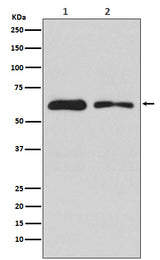 Anti-DOPA Decarboxylase Rabbit Monoclonal Antibody Boster Bio
