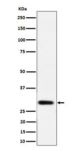 Anti-NAT1 Rabbit Monoclonal Antibody Boster Bio