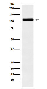 Anti-MIB1 / DIP1 Rabbit Monoclonal Antibody Boster Bio