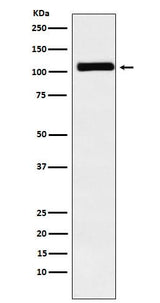 Anti-MIB1 / DIP1 Rabbit Monoclonal Antibody Boster Bio