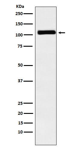 Anti-MIB1 / DIP1 Rabbit Monoclonal Antibody Boster Bio