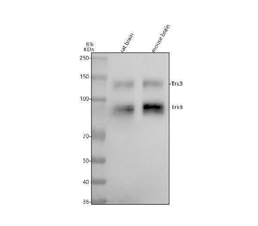 Anti-TrkB Rabbit Monoclonal Antibody Boster Bio