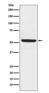 Anti-SPHK1 Monoclonal Antibody Boster Bio