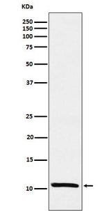 Anti-Estrogen Inducible Protein pS2 Monoclonal Antibody Boster Bio