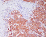 Anti-ALDH1A1 Rabbit Monoclonal Antibody Boster Bio