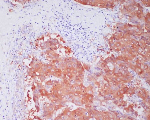 Anti-ALDH1A1 Rabbit Monoclonal Antibody Boster Bio