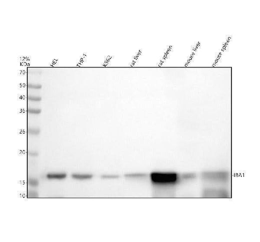 Anti-Iba1 Rabbit Monoclonal Antibody Boster Bio