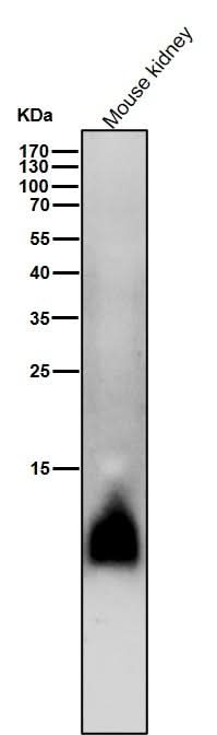Anti-Phospho-Phospholamban (S16) Rabbit Monoclonal Antibody Boster Bio
