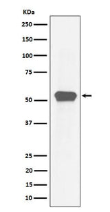 Anti-MEF2A Rabbit Monoclonal Antibody Boster Bio