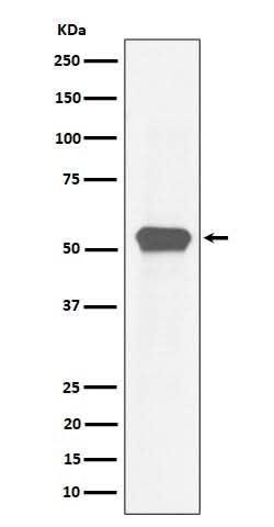 Anti-MEF2A Rabbit Monoclonal Antibody Boster Bio