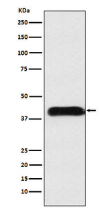 Anti-M6PR Rabbit Monoclonal Antibody Boster Bio