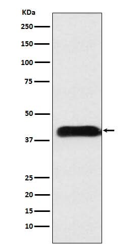 Anti-M6PR Rabbit Monoclonal Antibody Boster Bio