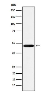 Anti-CD16 Rabbit Monoclonal Antibody Boster Bio