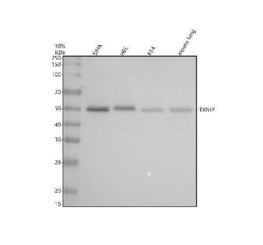 Anti-TXNIP Monoclonal Antibody Boster Bio