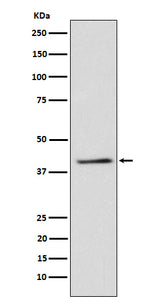 Anti-TRIB3 Rabbit Monoclonal Antibody Boster Bio