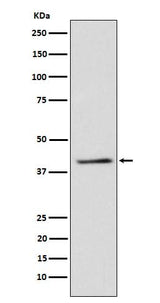 Anti-TRIB3 Rabbit Monoclonal Antibody Boster Bio