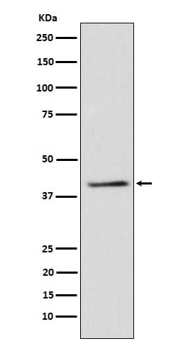 Anti-TRIB3 Rabbit Monoclonal Antibody Boster Bio