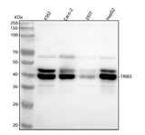 Anti-TRIB3 Monoclonal Antibody Boster Bio