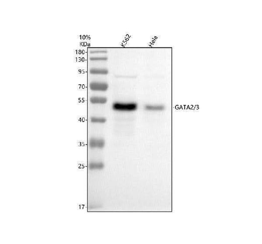 Anti-GATA2/3 Rabbit Monoclonal Antibody Boster Bio