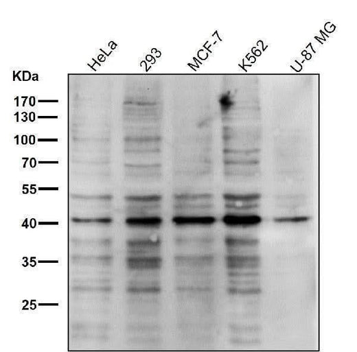 Anti-PRMT1 Rabbit Monoclonal Antibody Boster Bio