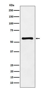 Anti-PAK2 Monoclonal Antibody Boster Bio